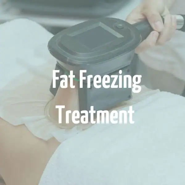 fat freezing treatment Kenilworth